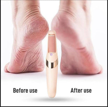 Rechargeable Electric Foot File Callus Remover Pedicure Machine Apparatus for Heels Grinding Device Foot Corns Remove Roller Feet Care